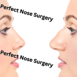 Perfect Nose Surgery